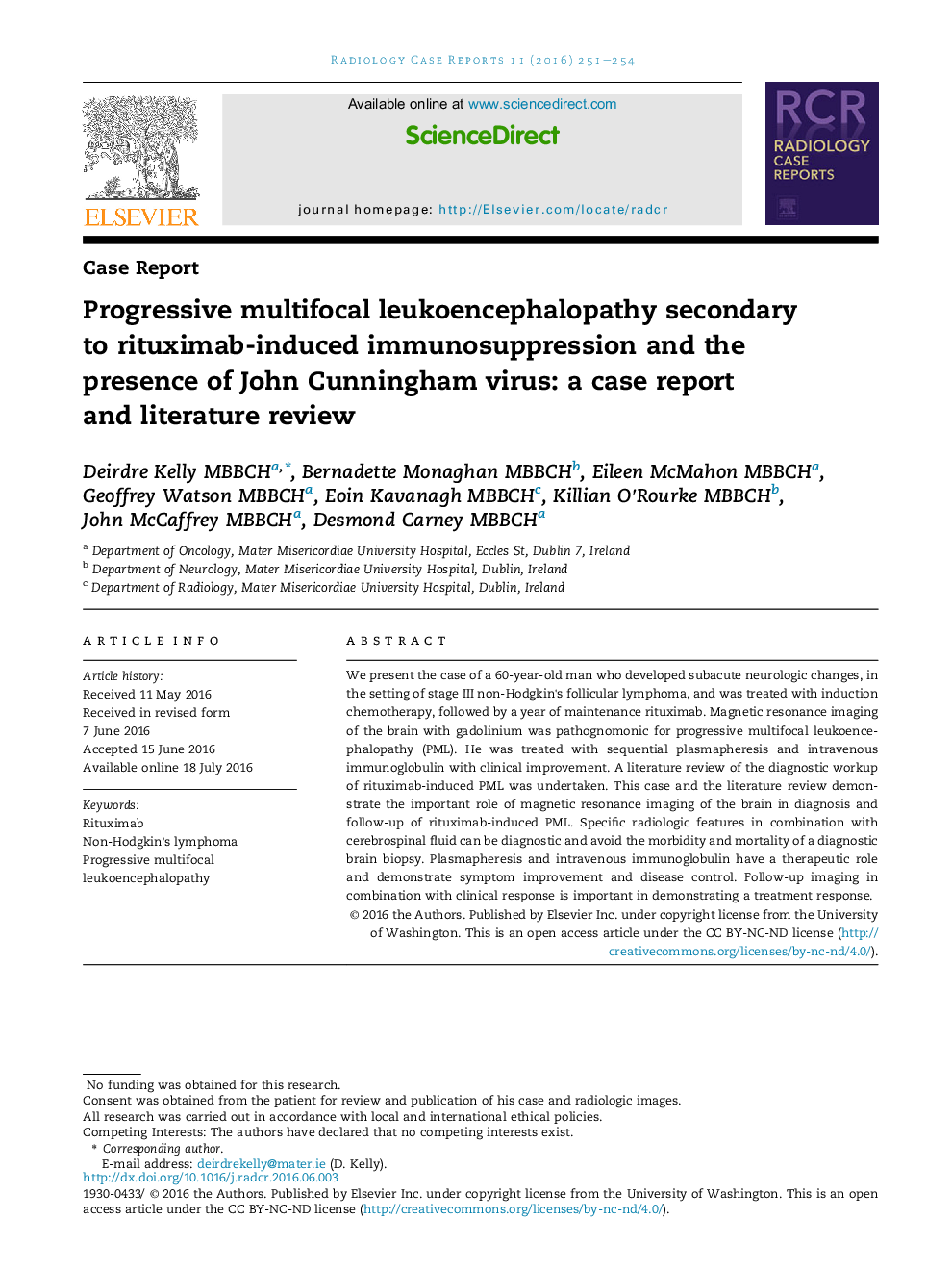 Leukoencephalopathy multifocal پیشرفته به دلیل سرکوب ایمنی ناشی از ریتوکسیماب و حضور ویروس John Cunningham: گزارش موردی و بررسی ادبیات