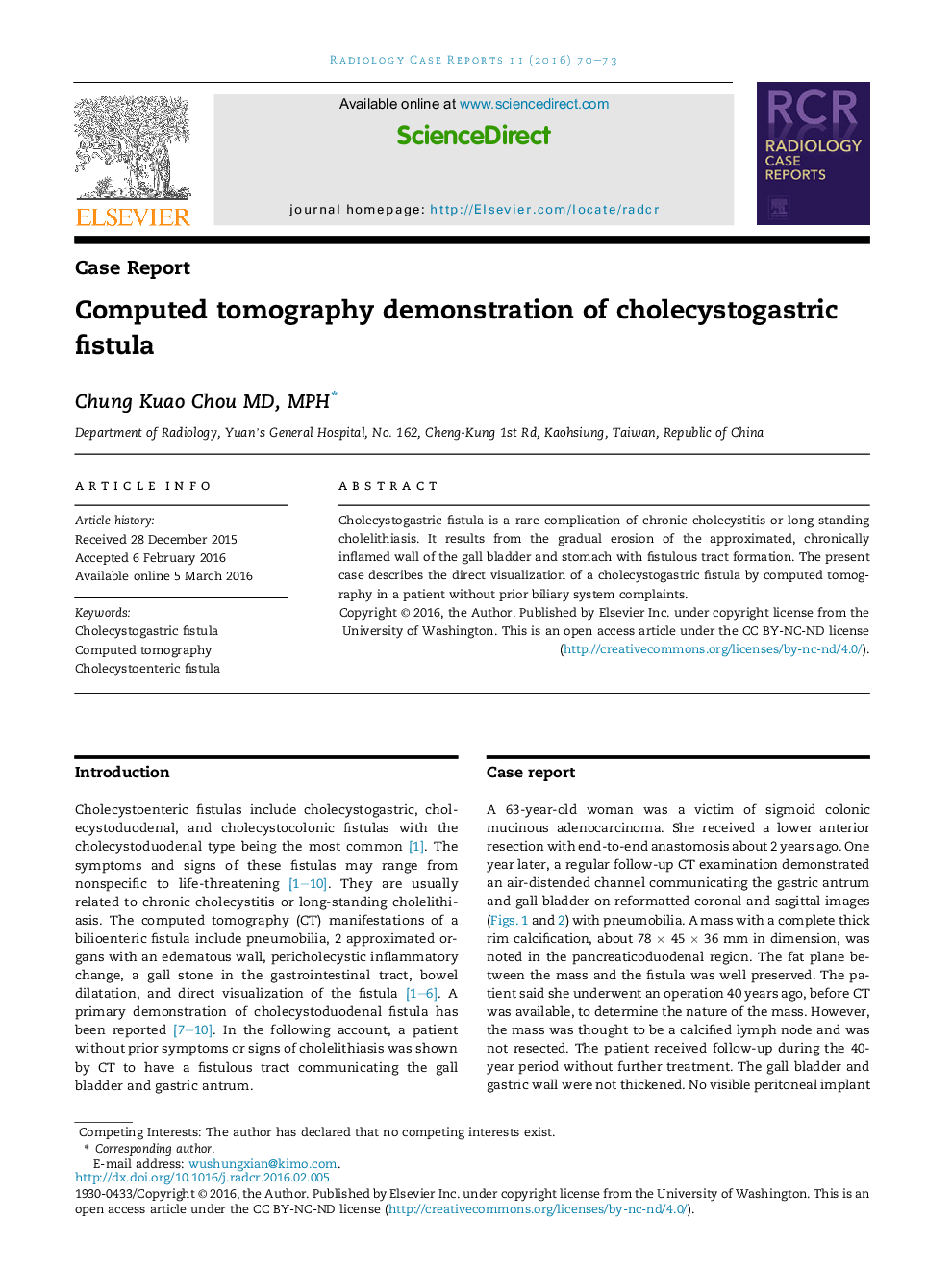 Computed tomography demonstration of cholecystogastric fistula 