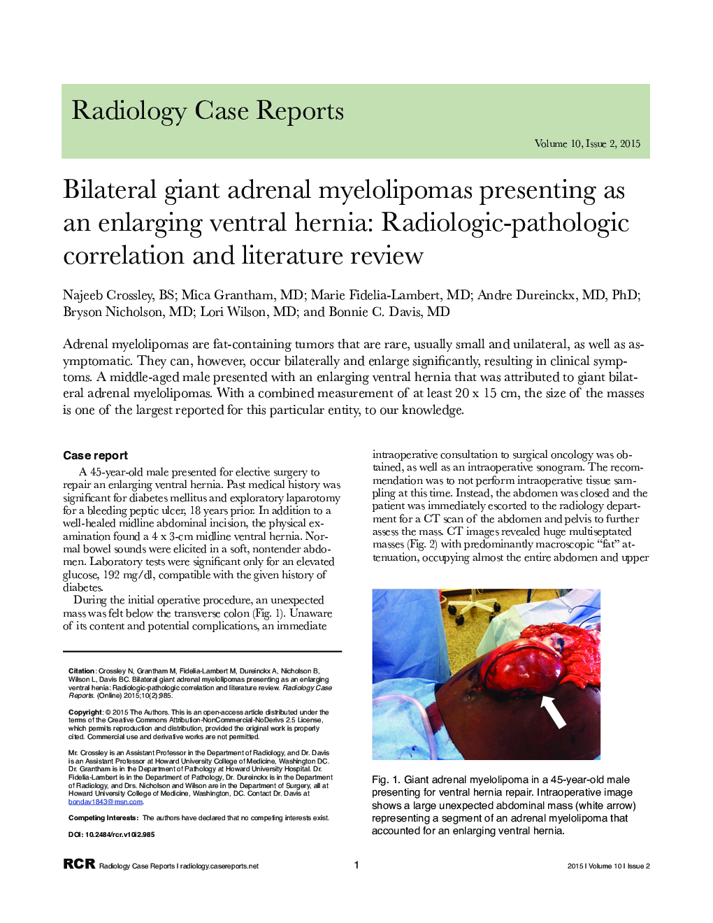 Bilateral giant adrenal myelolipomas presenting as an enlarging ventral hernia: Radiologic-pathologic correlation and literature review