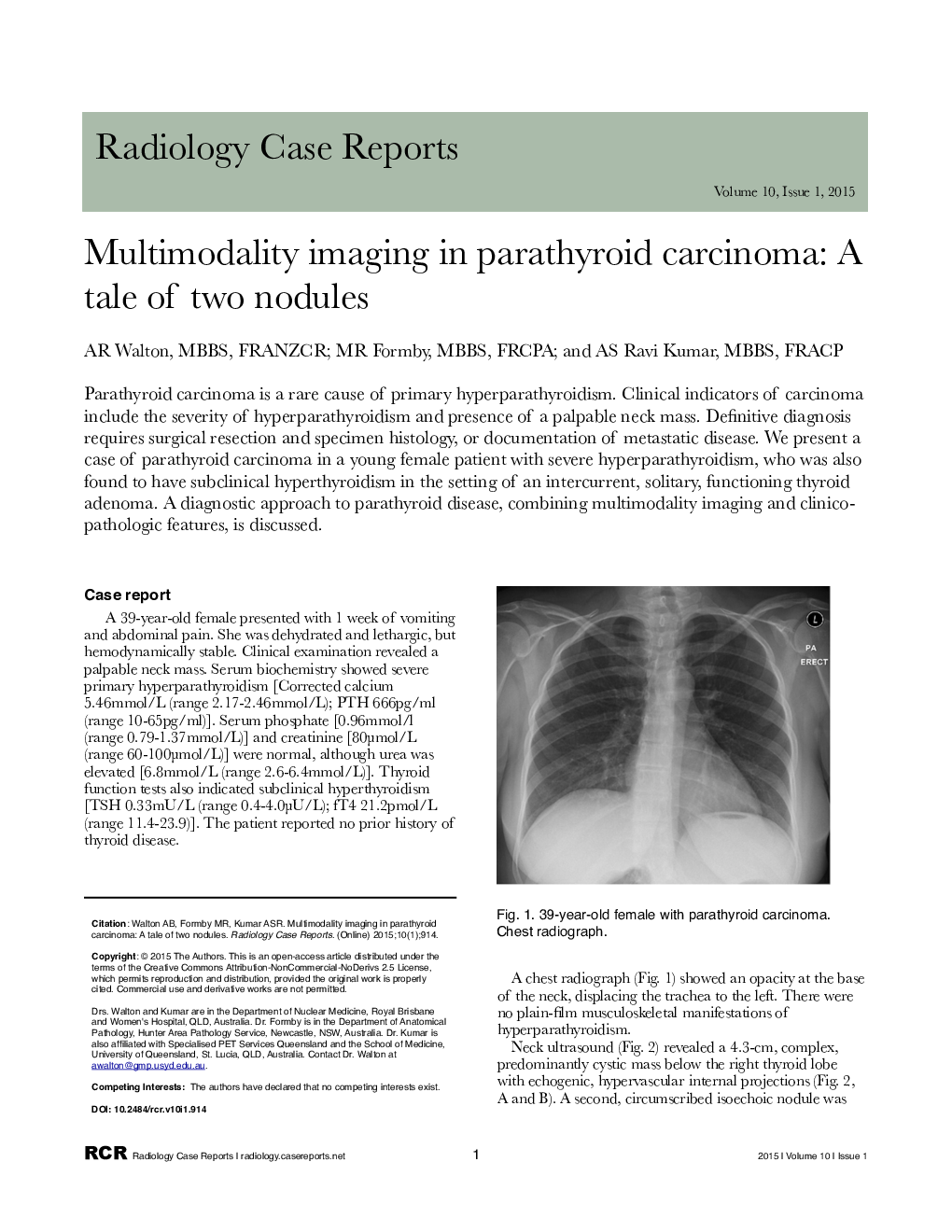 Multimodality imaging in parathyroid carcinoma: A tale of two nodules