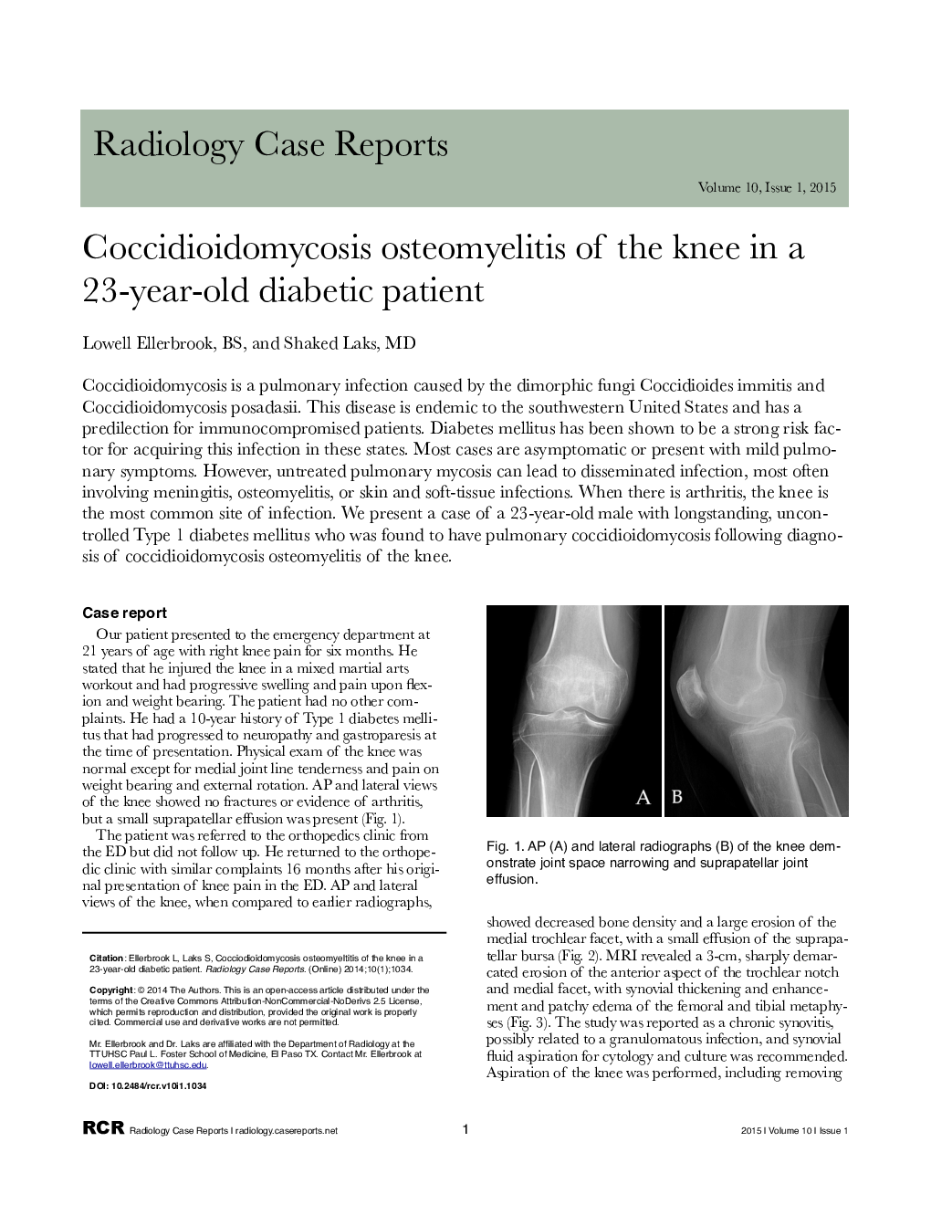 Coccidioidomycosis osteomyelitis of the knee in a 23-year-old diabetic patient