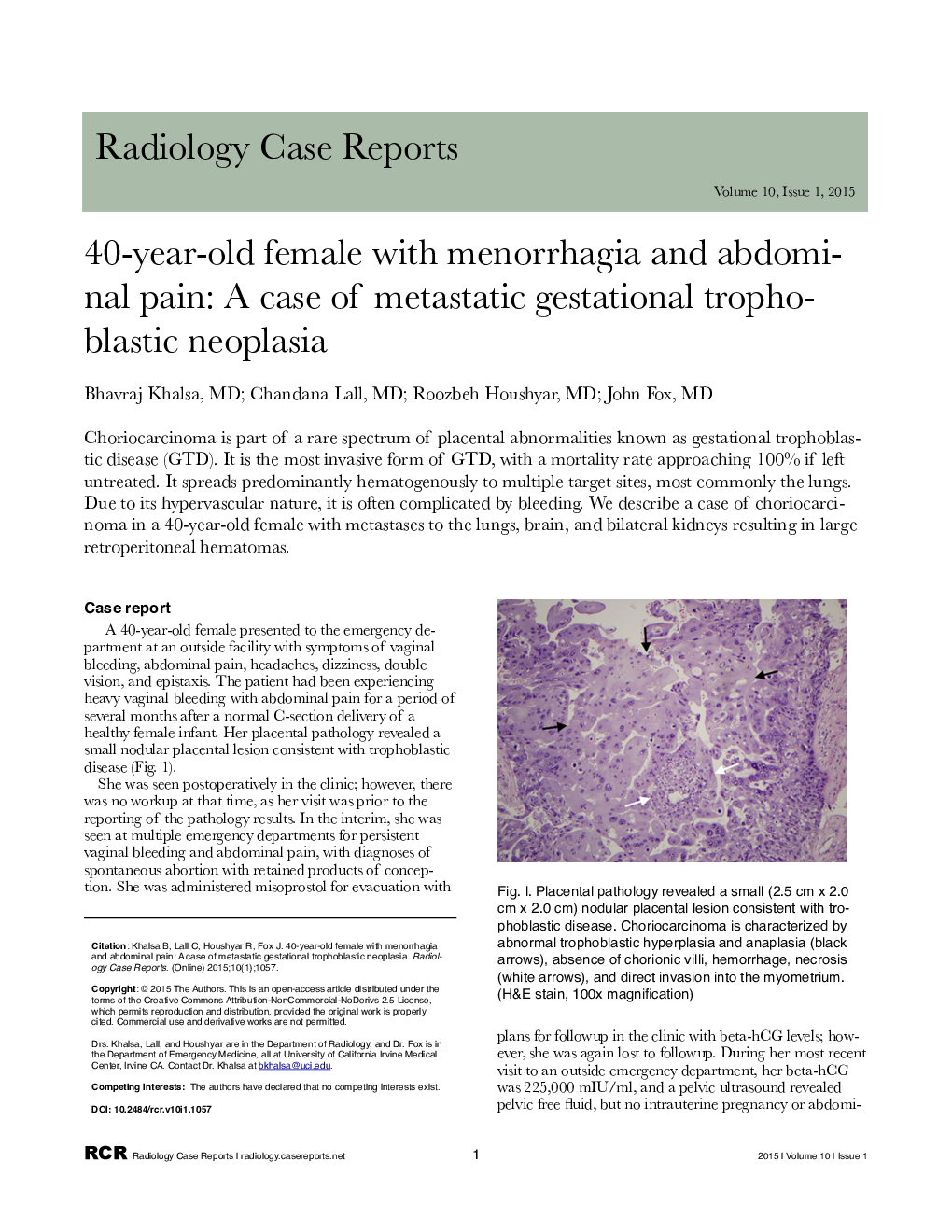 40-year-old female with menorrhagia and abdominal pain: A case of metastatic gestational trophoblastic neoplasia