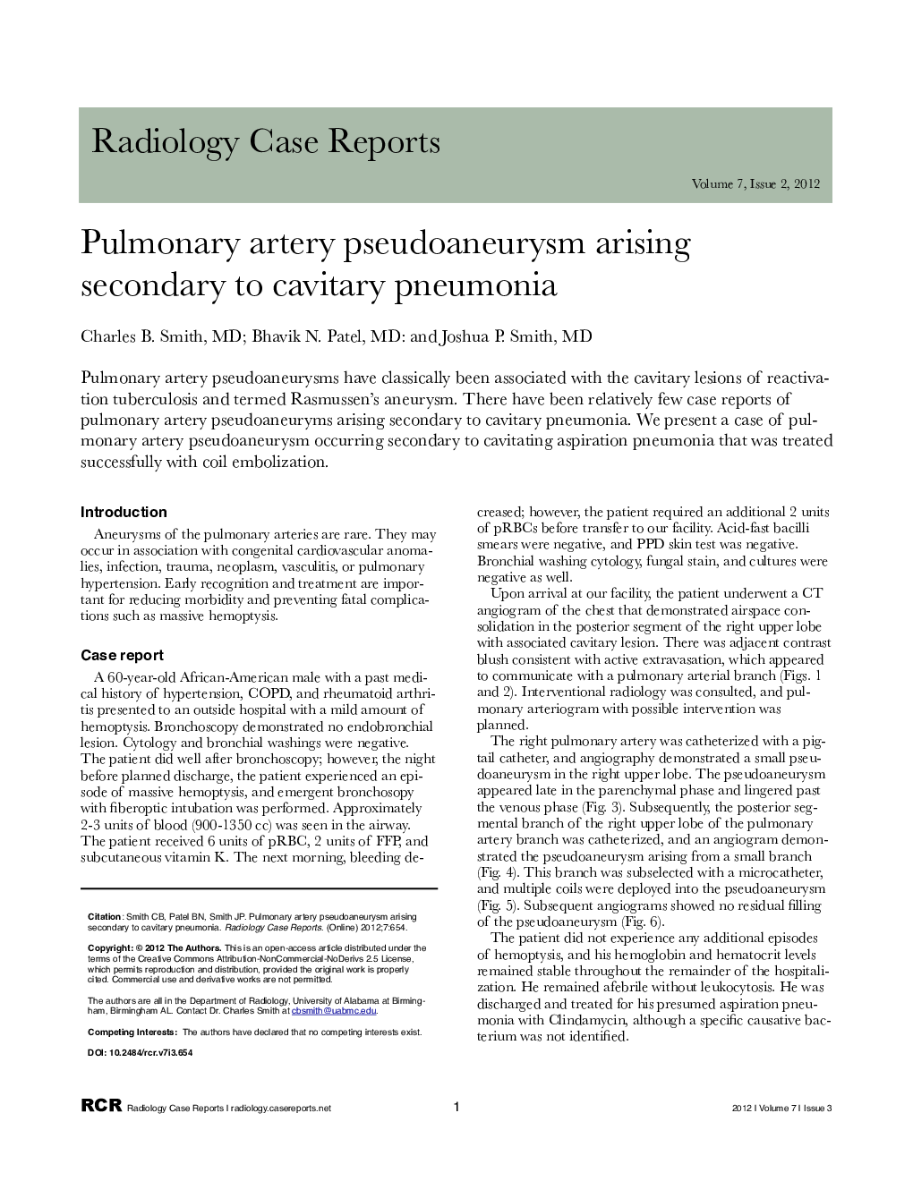 Pulmonary artery pseudoaneurysm arising secondary to cavitary pneumonia