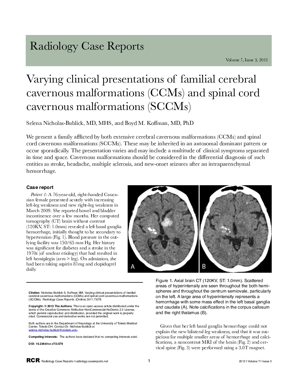 Varying clinical presentations of familial cerebral cavernous malformations (CCMs) and spinal cord cavernous malformations (SCCMs)