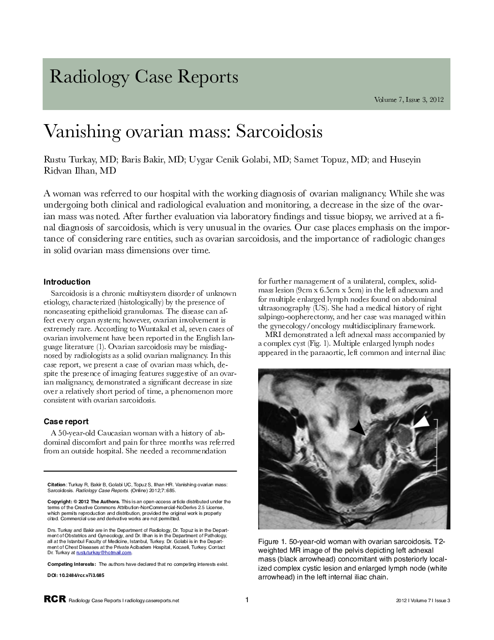 Vanishing ovarian mass: Sarcoidosis
