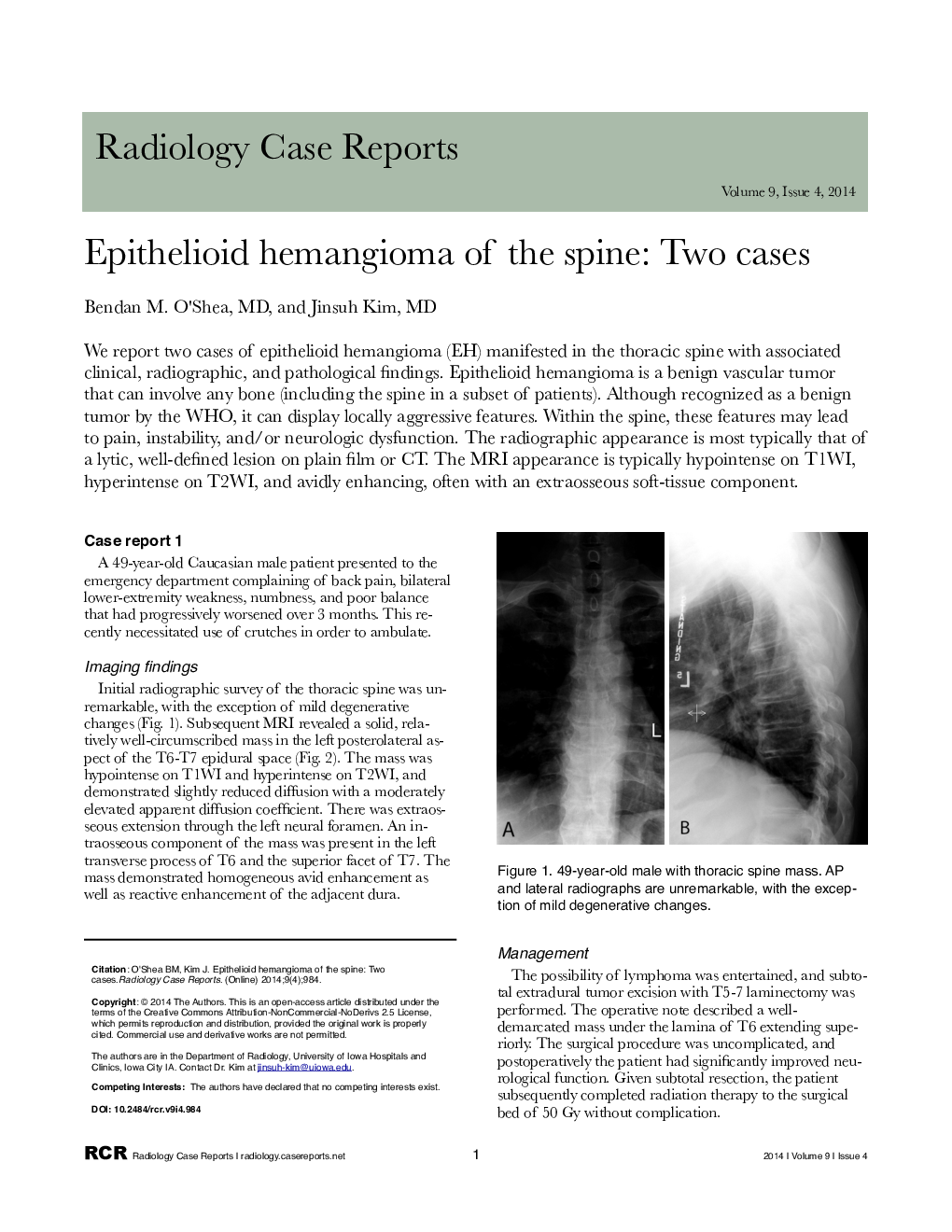 Epithelioid hemangioma of the spine: Two cases