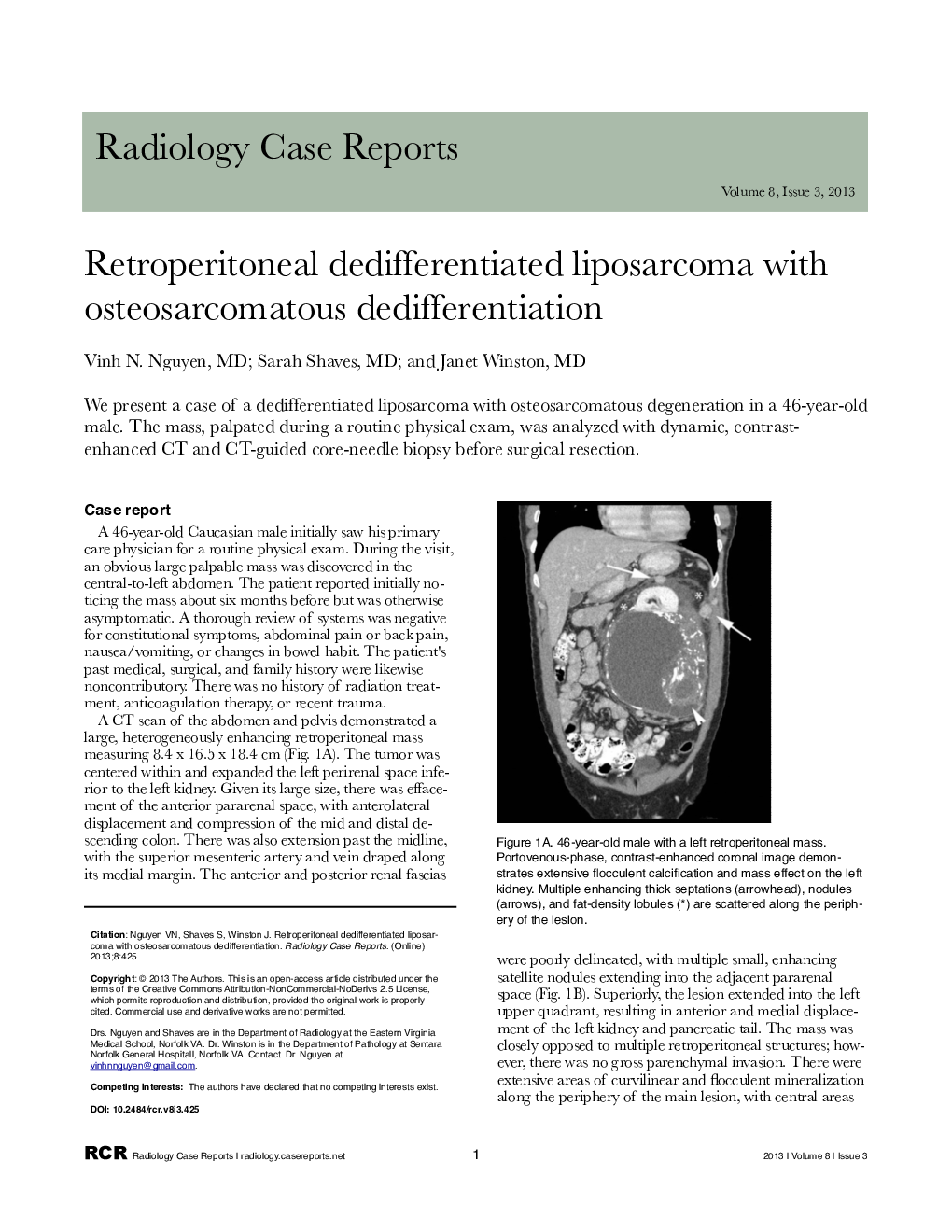 Retroperitoneal dedifferentiated liposarcoma with osteosarcomatous dedifferentiation