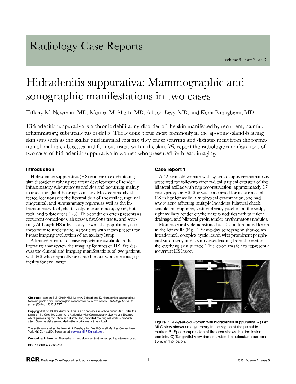 Hidradenitis suppurativa: Mammographic and sonographic manifestations in two cases