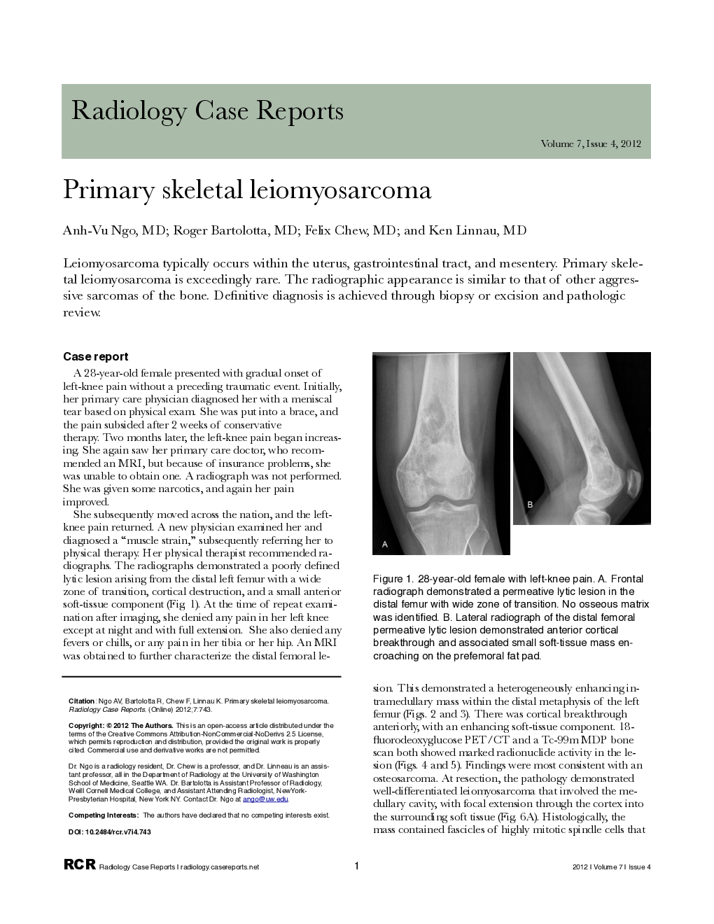 Primary skeletal leiomyosarcoma