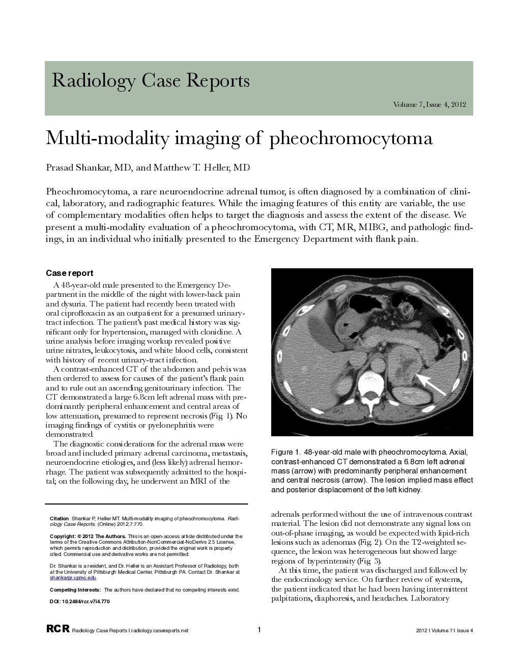 Multi-modality imaging of pheochromocytoma