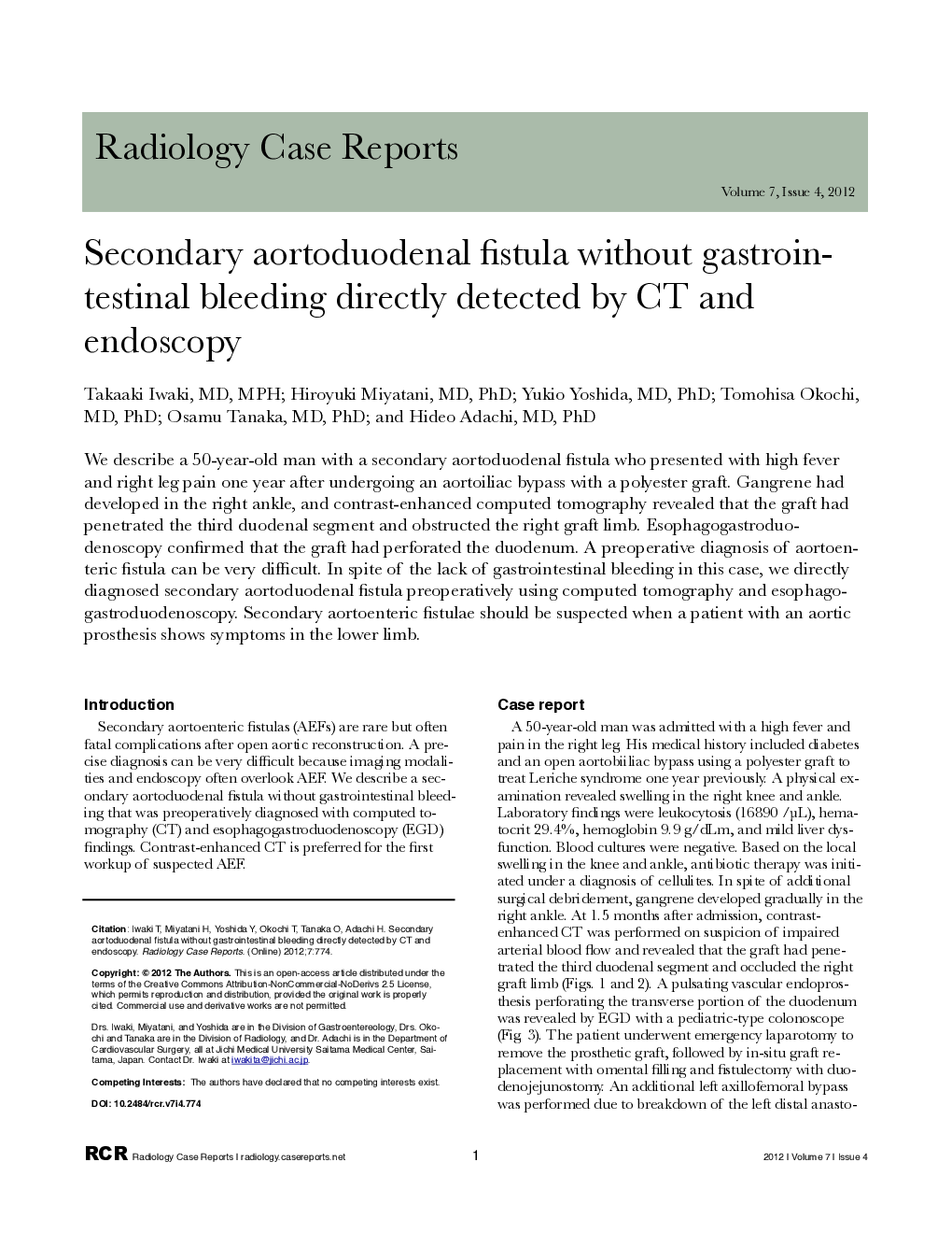 Secondary aortoduodenal fistula without gastrointestinal bleeding directly detected by CT and endoscopy