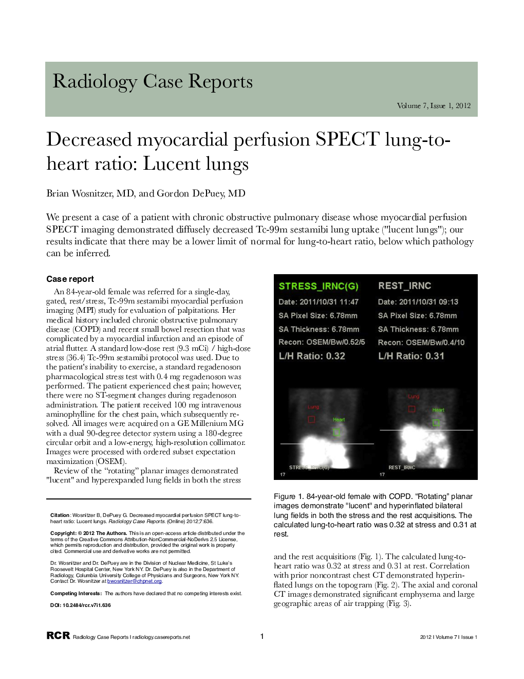 Decreased myocardial perfusion SPECT lung-to-heart ratio: Lucent lungs