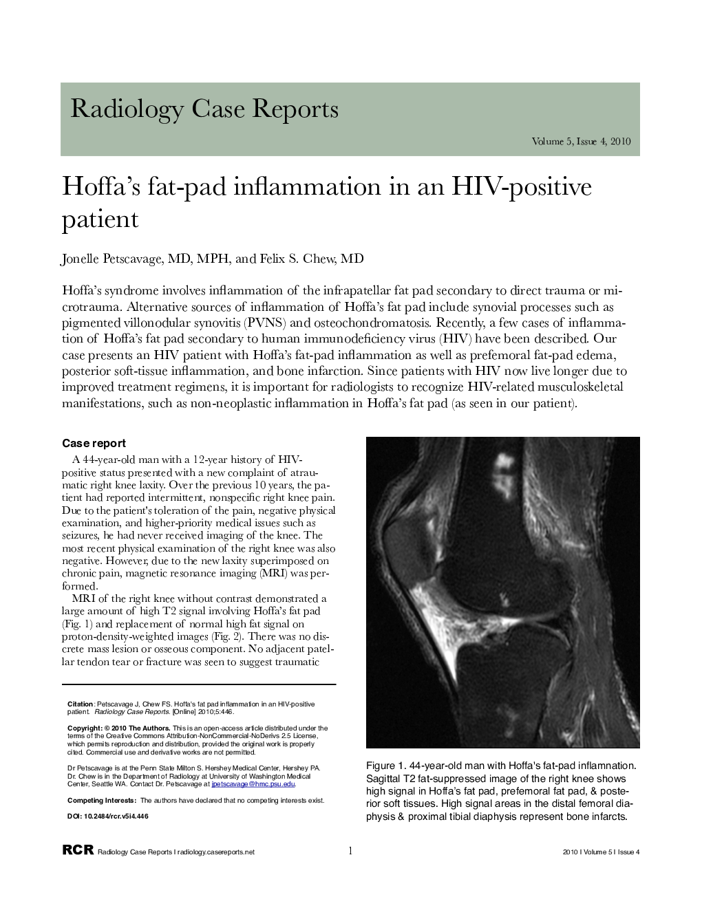 Hoffa's fat-pad inflammation in an HIV-positive patient