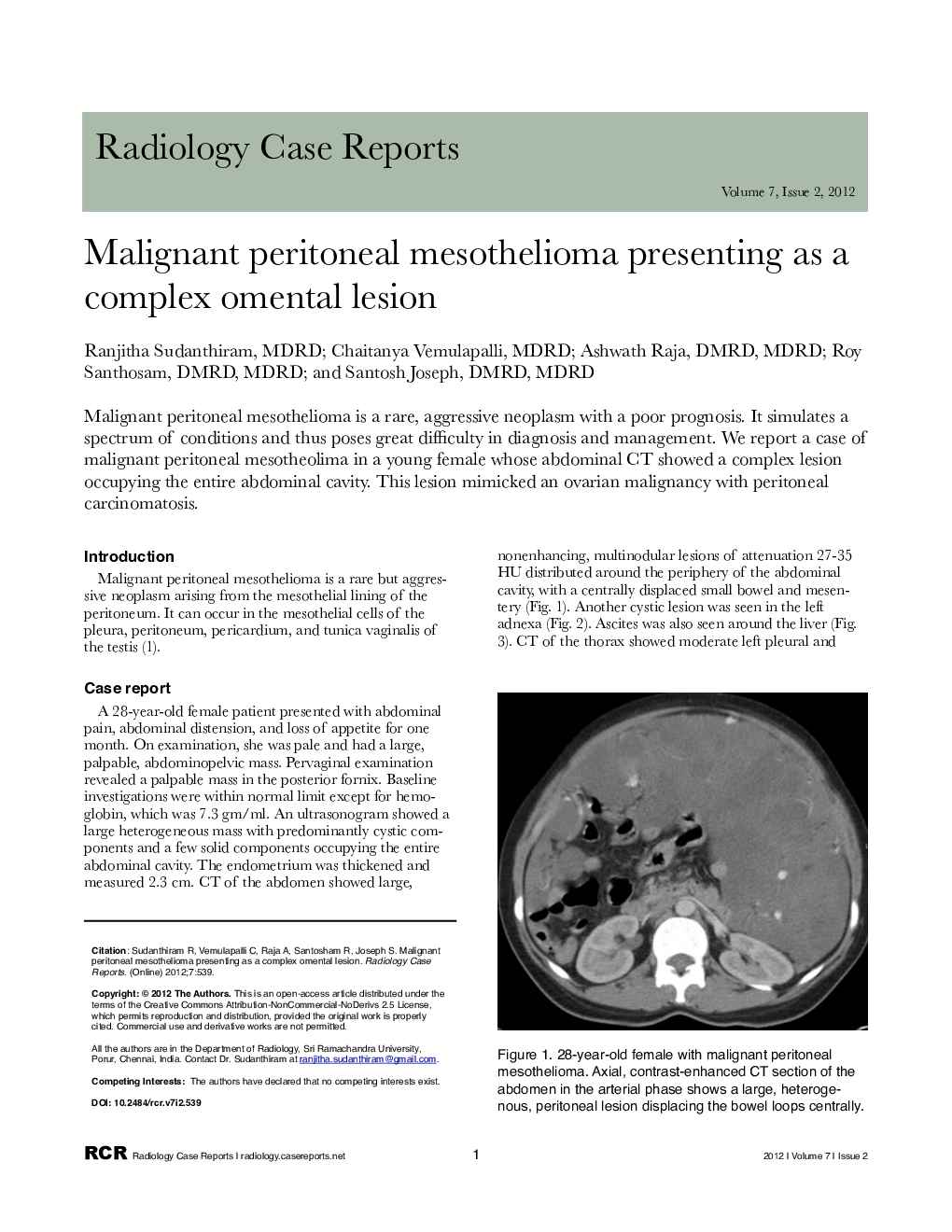 Malignant peritoneal mesothelioma presenting as a complex omental lesion