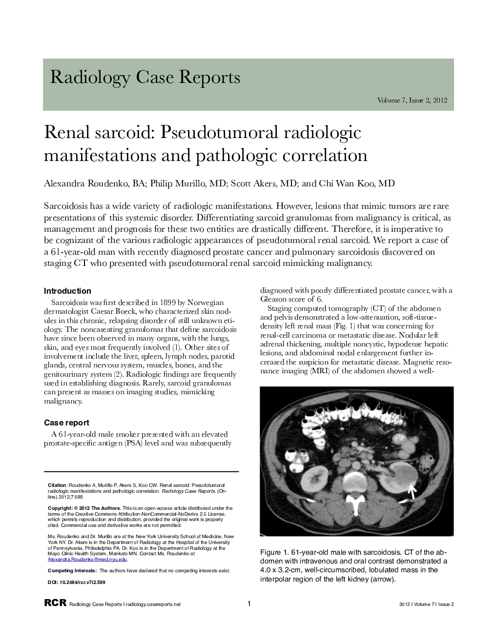 Renal sarcoid: Pseudotumoral radiologic manifestations and pathologic correlation