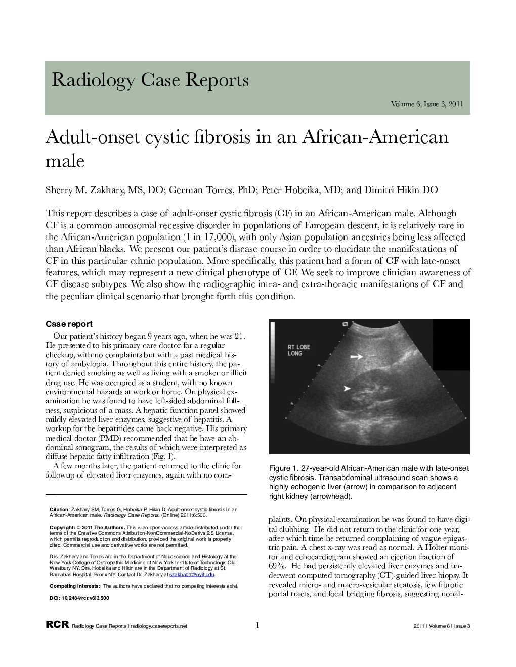 Adult-onset cystic fibrosis in an African-American male