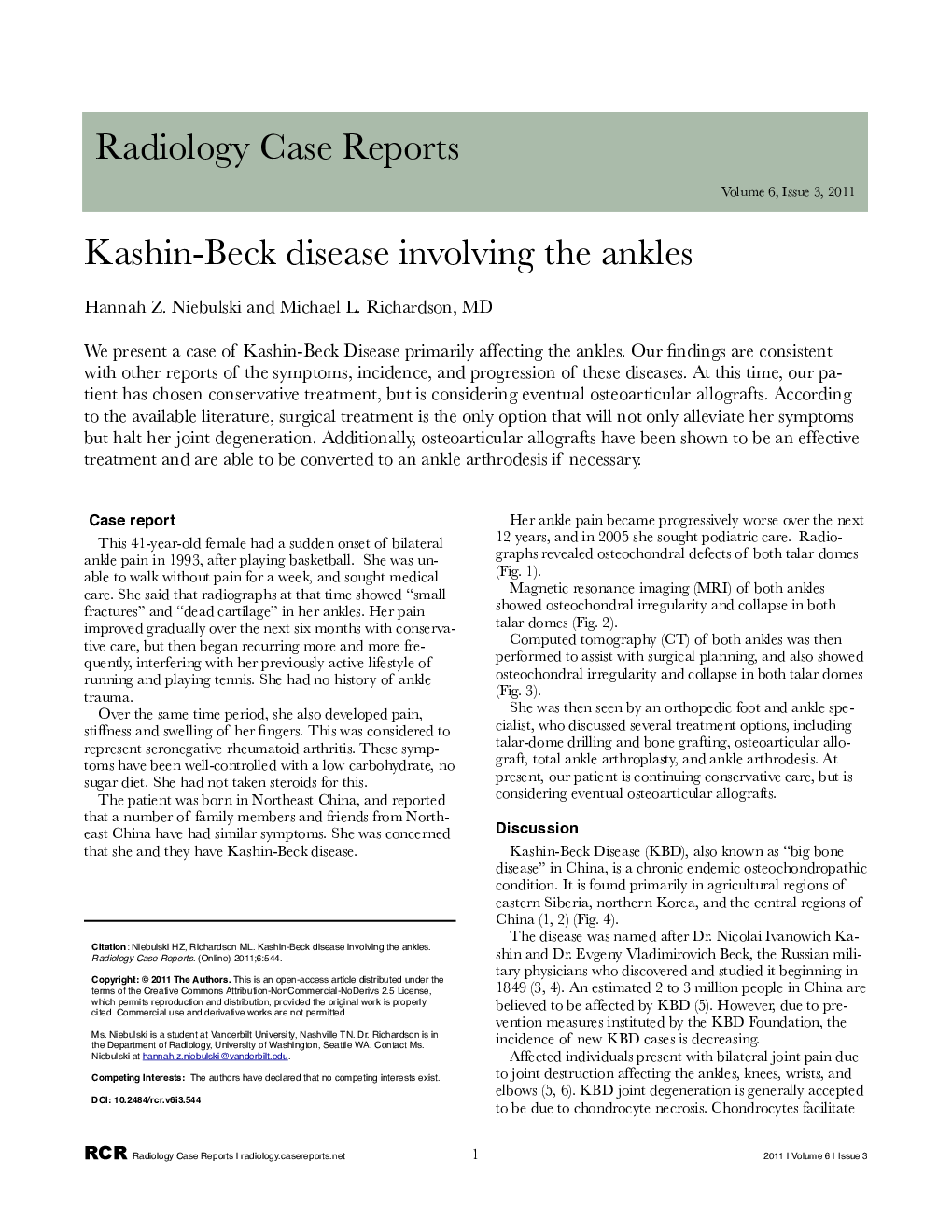 Kashin-Beck disease involving the ankles