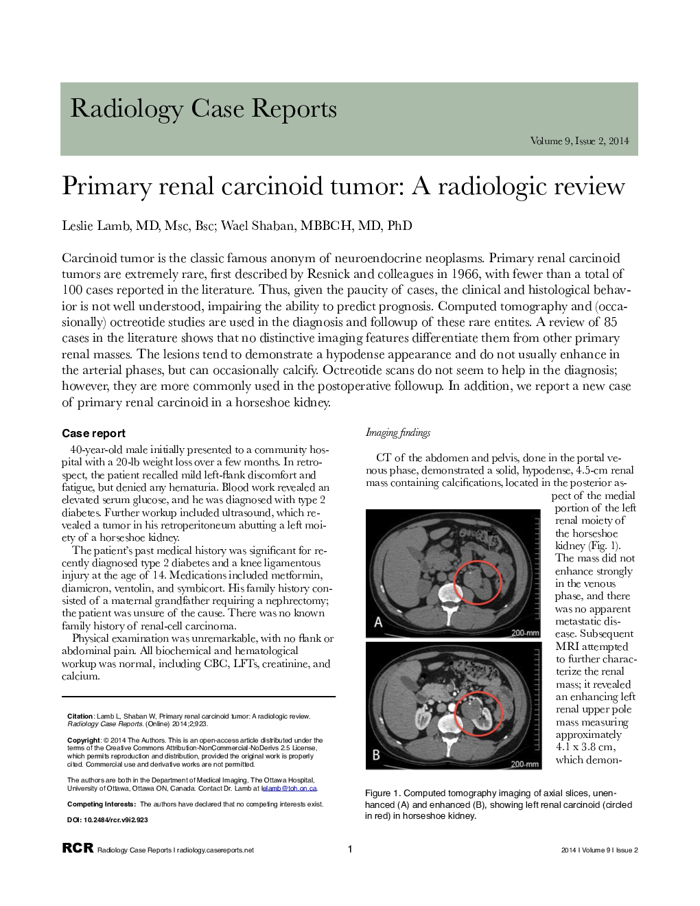 Primary renal carcinoid tumor: A radiologic review