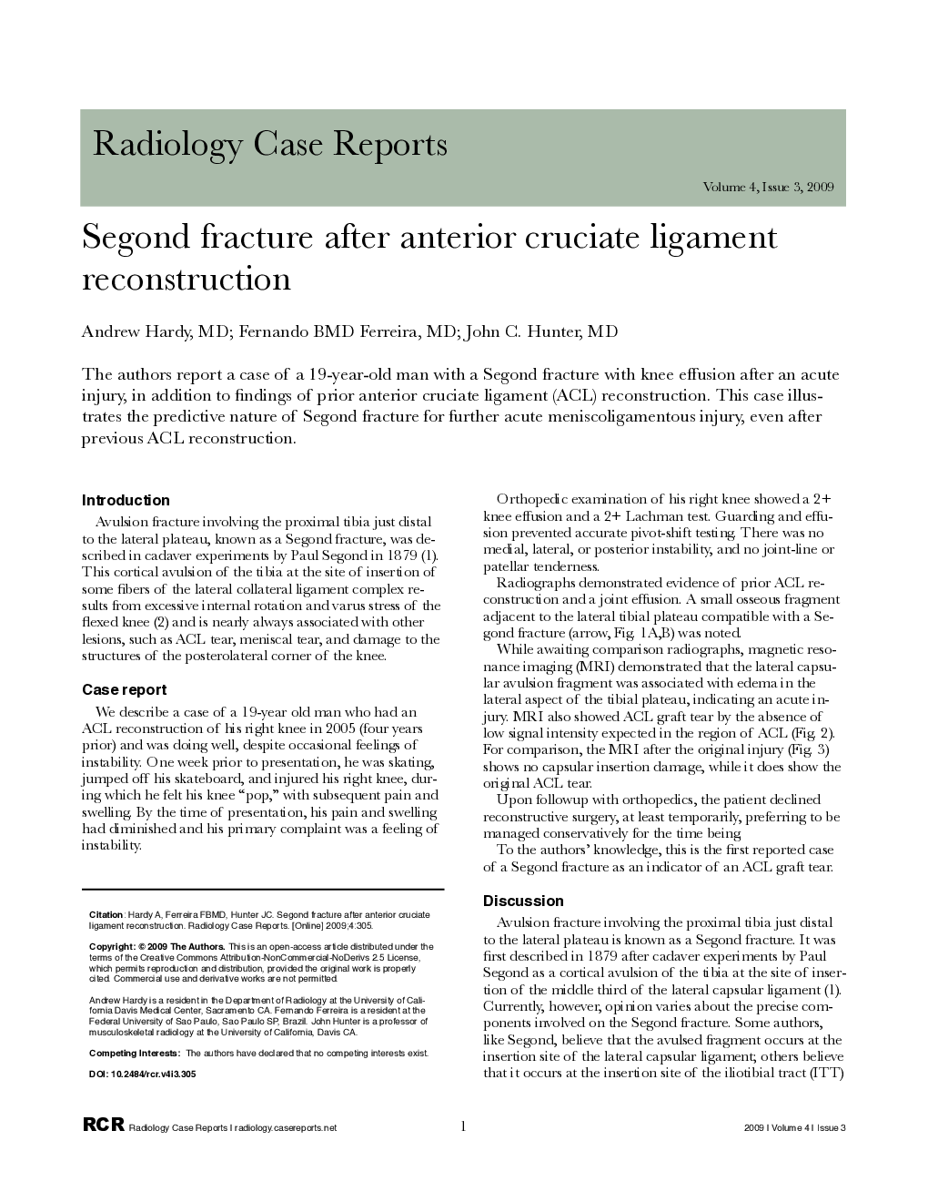 Segond fracture after anterior cruciate ligament reconstruction