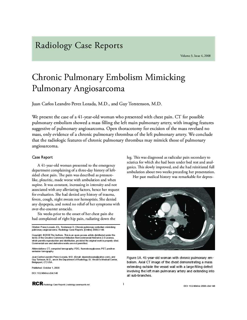 Chronic Pulmonary Embolism Mimicking Pulmonary Angiosarcoma