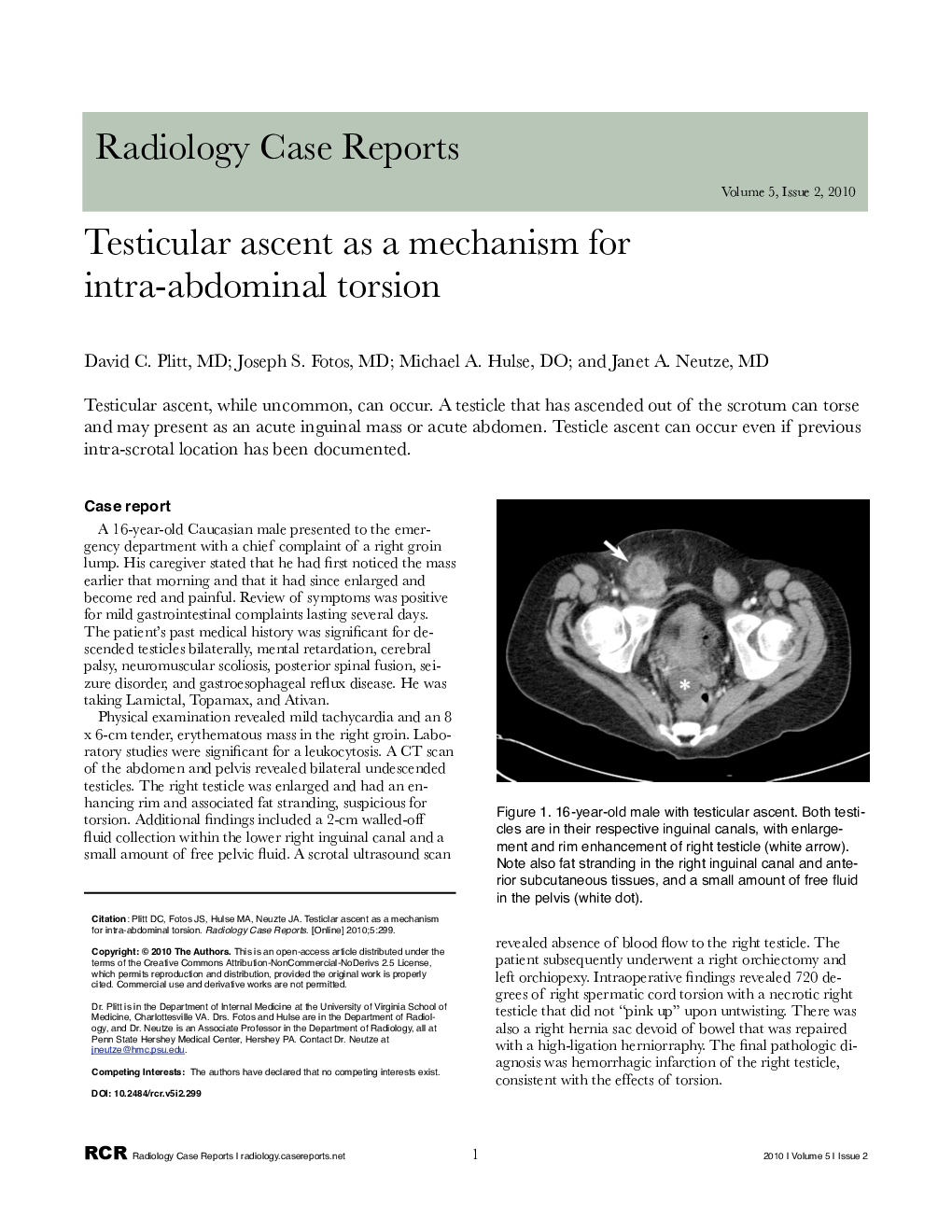 Testicular ascent as a mechanism for intra-abdominal torsion