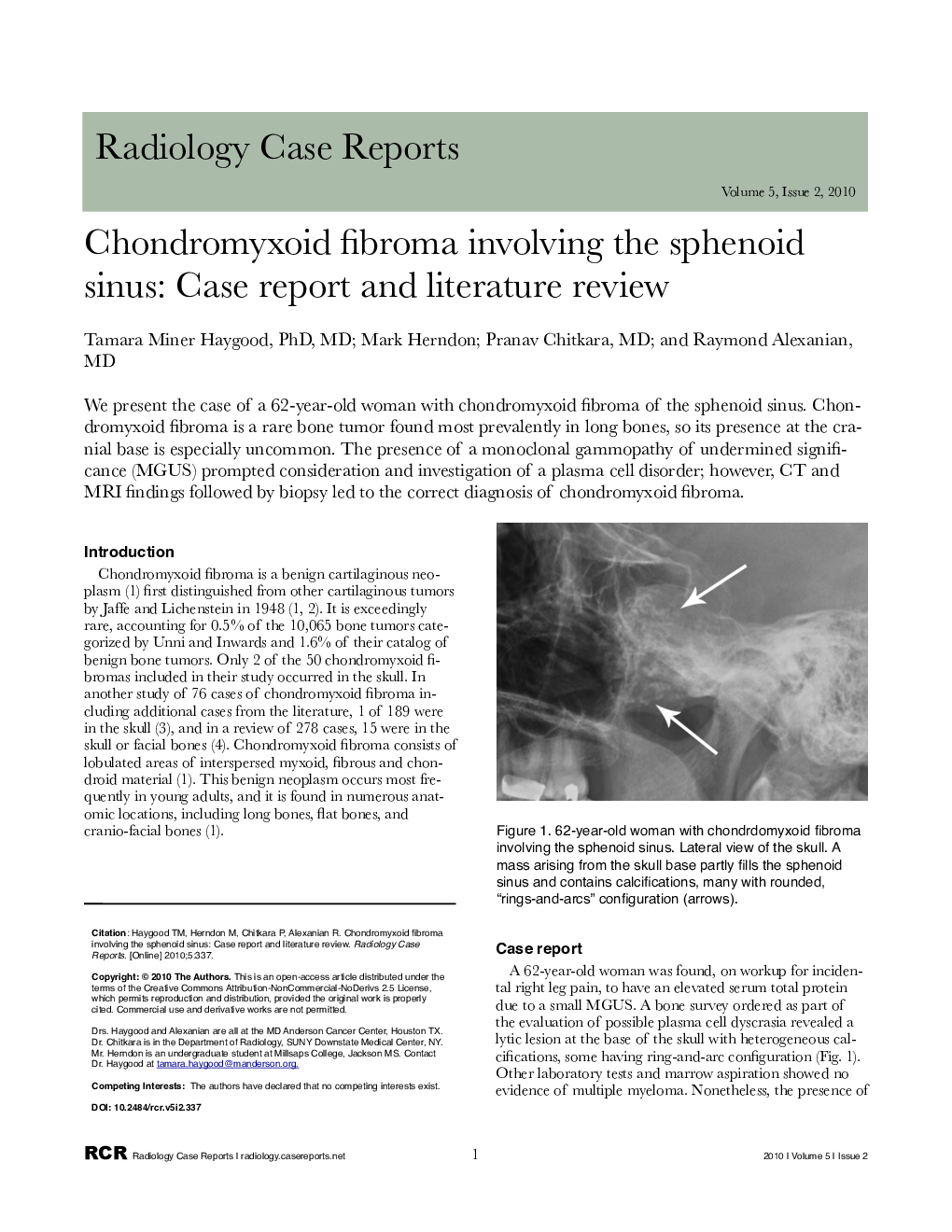 Chondromyxoid fibroma involving the sphenoid sinus: Case report and literature review