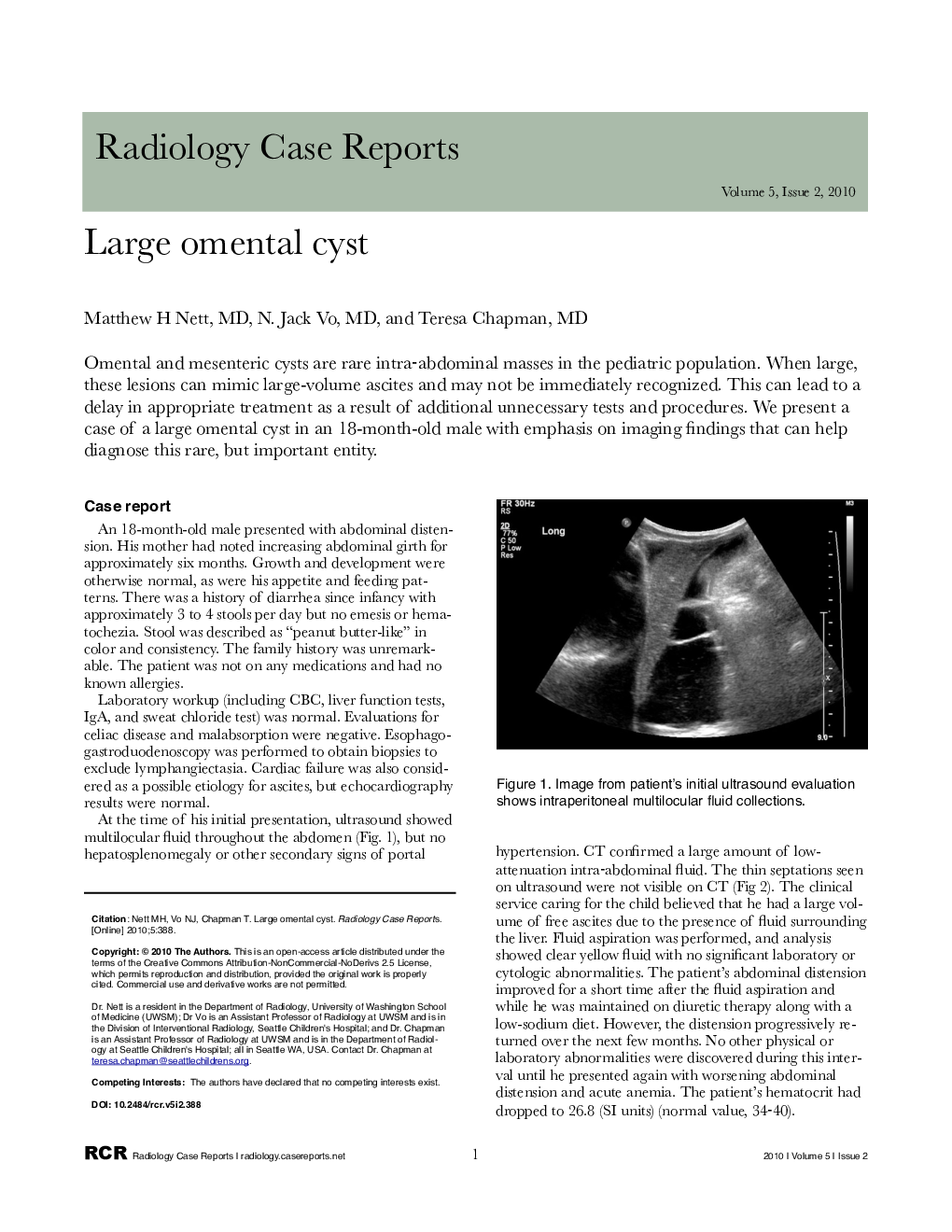 Large omental cyst