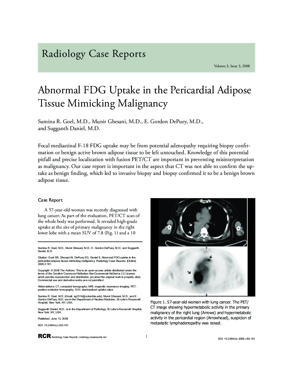 Abnormal FDG Uptake in the Pericardial Adipose Tissue Mimicking Malignancy