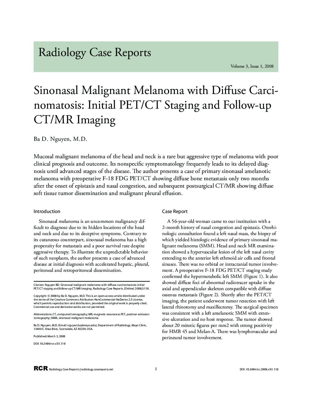 Sinonasal malignant melanoma with diffuse carcinomatosis: initial PET/CT staging and follow-up CT/MR imaging