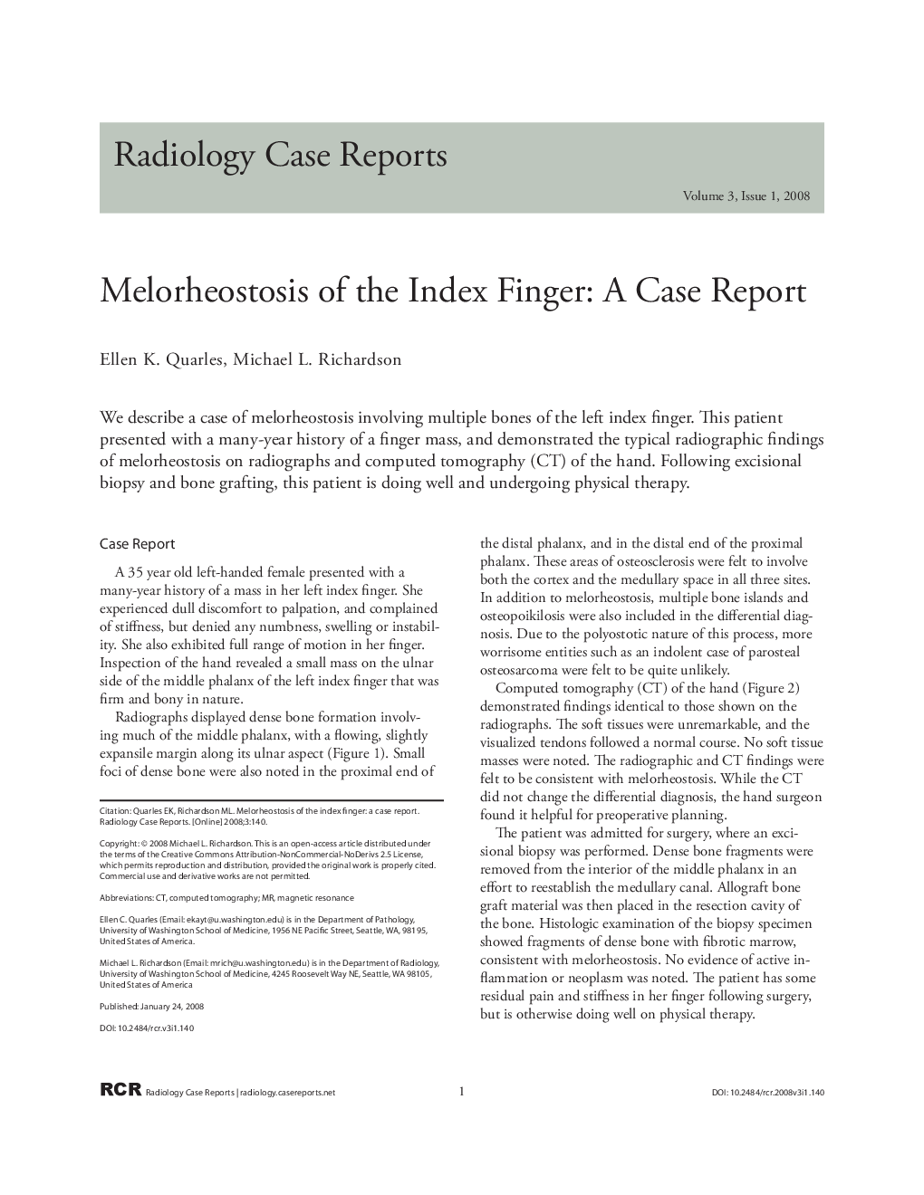 Melorheostosis of the index finger: a case report