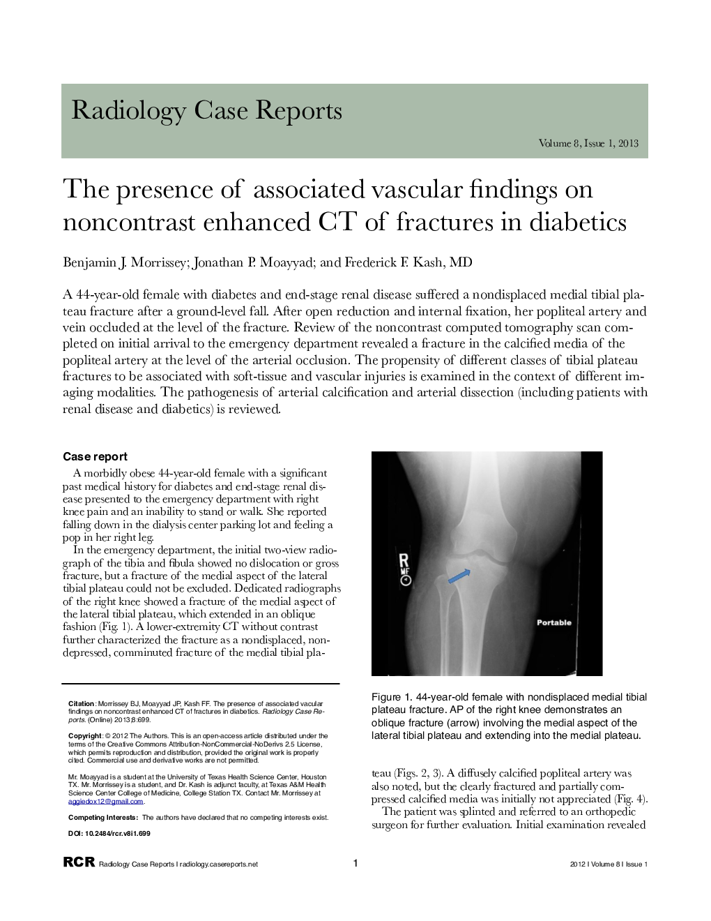 The presence of associated vascular findings on noncontrast enhanced CT of fractures in diabetics