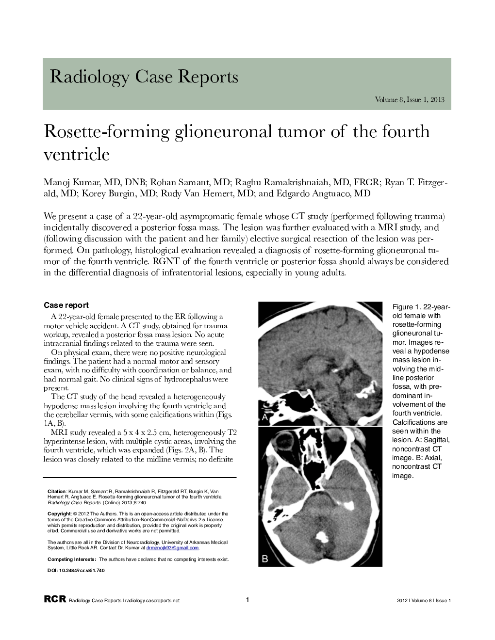 Rosette-forming glioneuronal tumor of the fourth ventricle