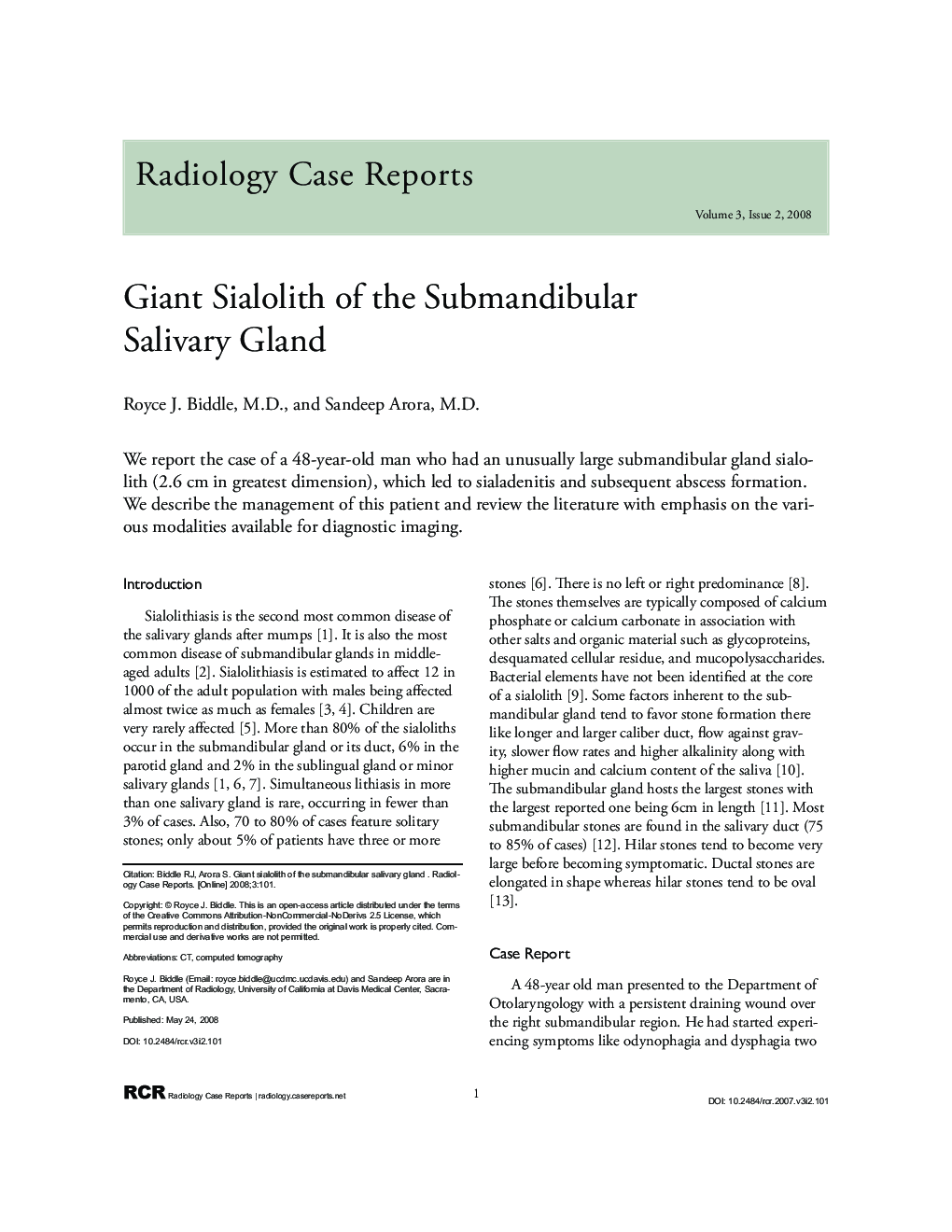 Giant Sialolith of the Submandibular Salivary Gland