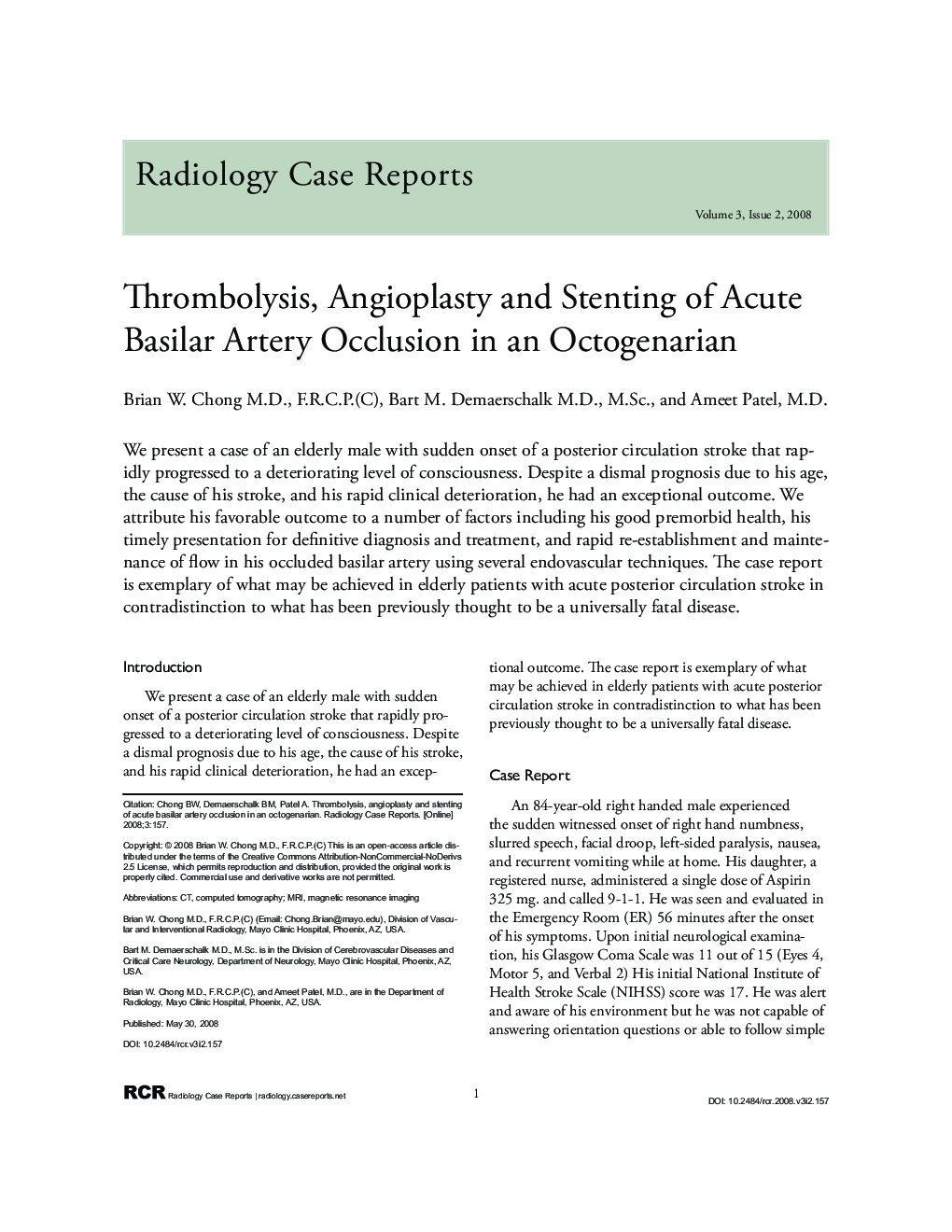 Thrombolysis, angioplasty and stenting of acute basilar artery occlusion in an octogenarian