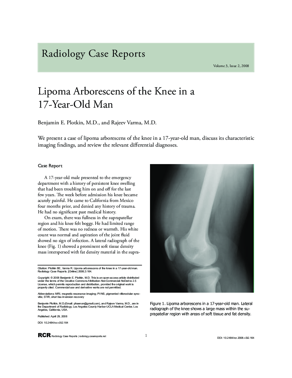 Lipoma Arborescens of the Knee in a 17-Year-Old Man