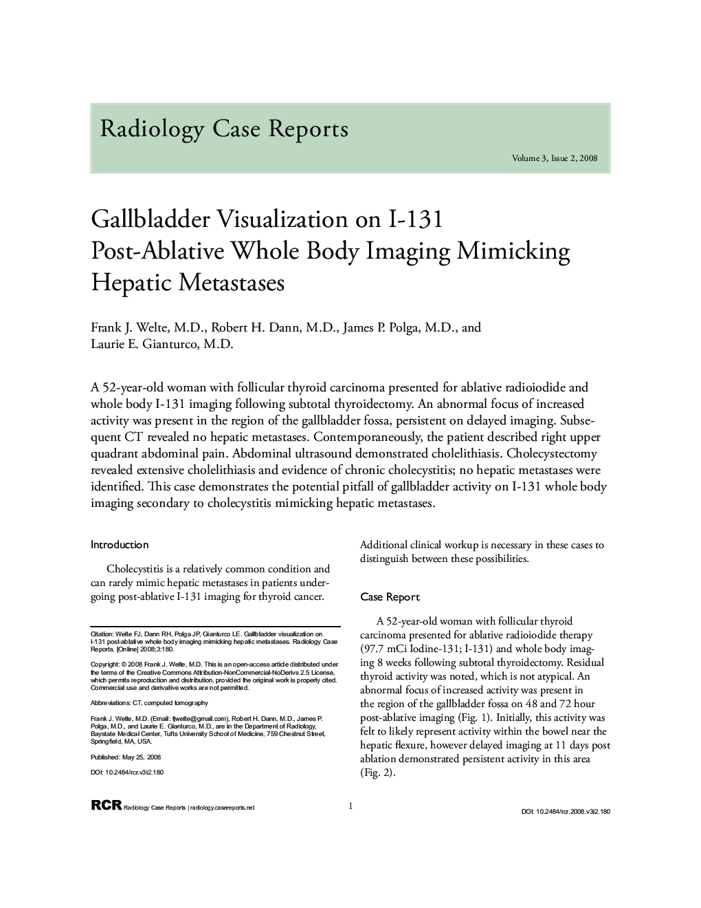 Gallbladder Visualization on I-131 Post-Ablative Whole Body Imaging Mimicking Hepatic Metastases