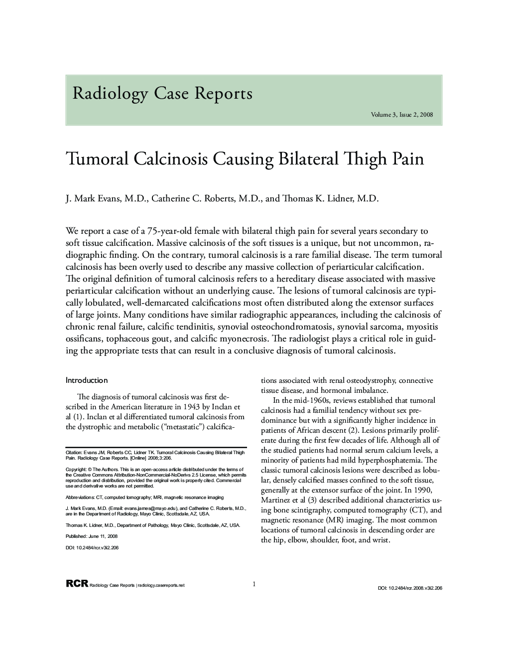 Tumoral Calcinosis Causing Bilateral Thigh Pain