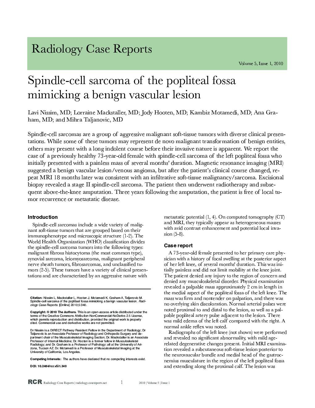 Spindle-cell sarcoma of the popliteal fossa mimicking a benign vascular lesion