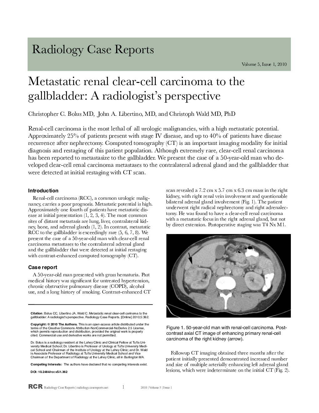 Metastatic renal clear-cell carcinoma to the gallbladder: A radiologist's perspective