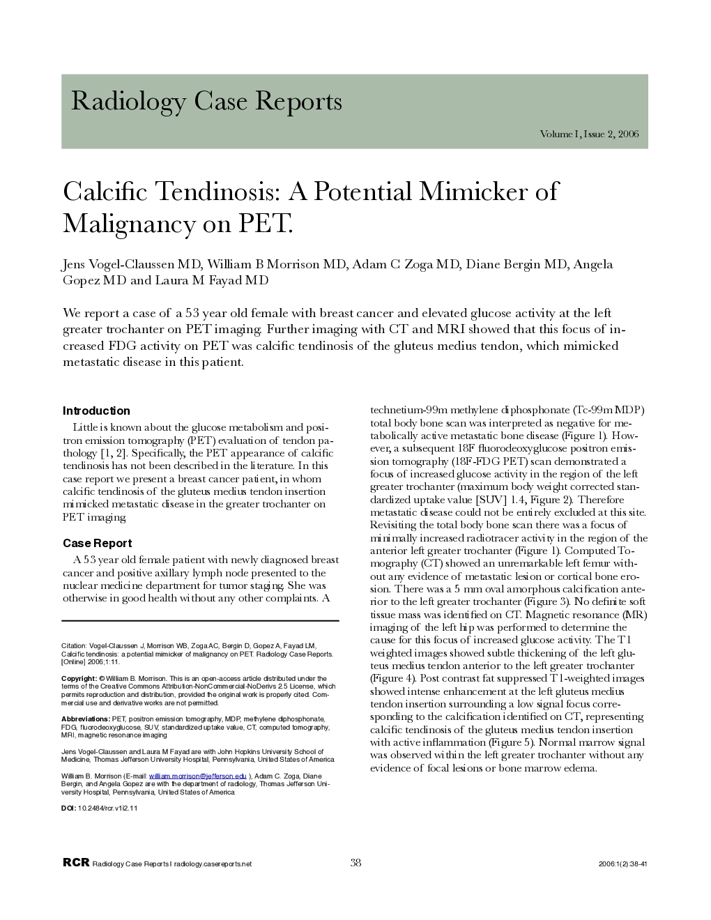 Calcific Tendinosis: A Potential Mimicker of Malignancy on PET 