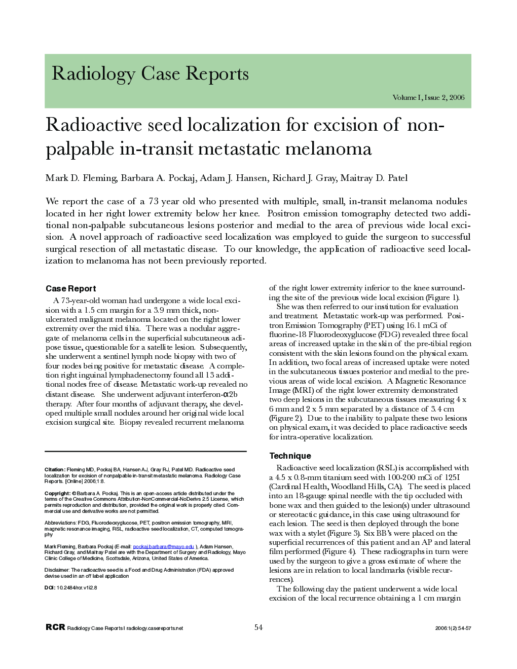 Radioactive seed localization for excision of non-palpable in-transit metastatic melanoma 