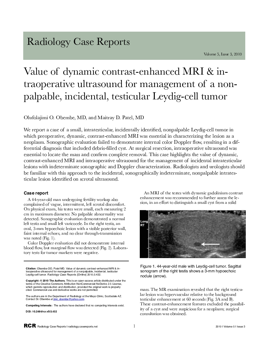 Value of dynamic, contrast-enhanced MRI & intraoperative ultrasound for management of a nonpalpable, incidental, testicular Leydig-cell tumor