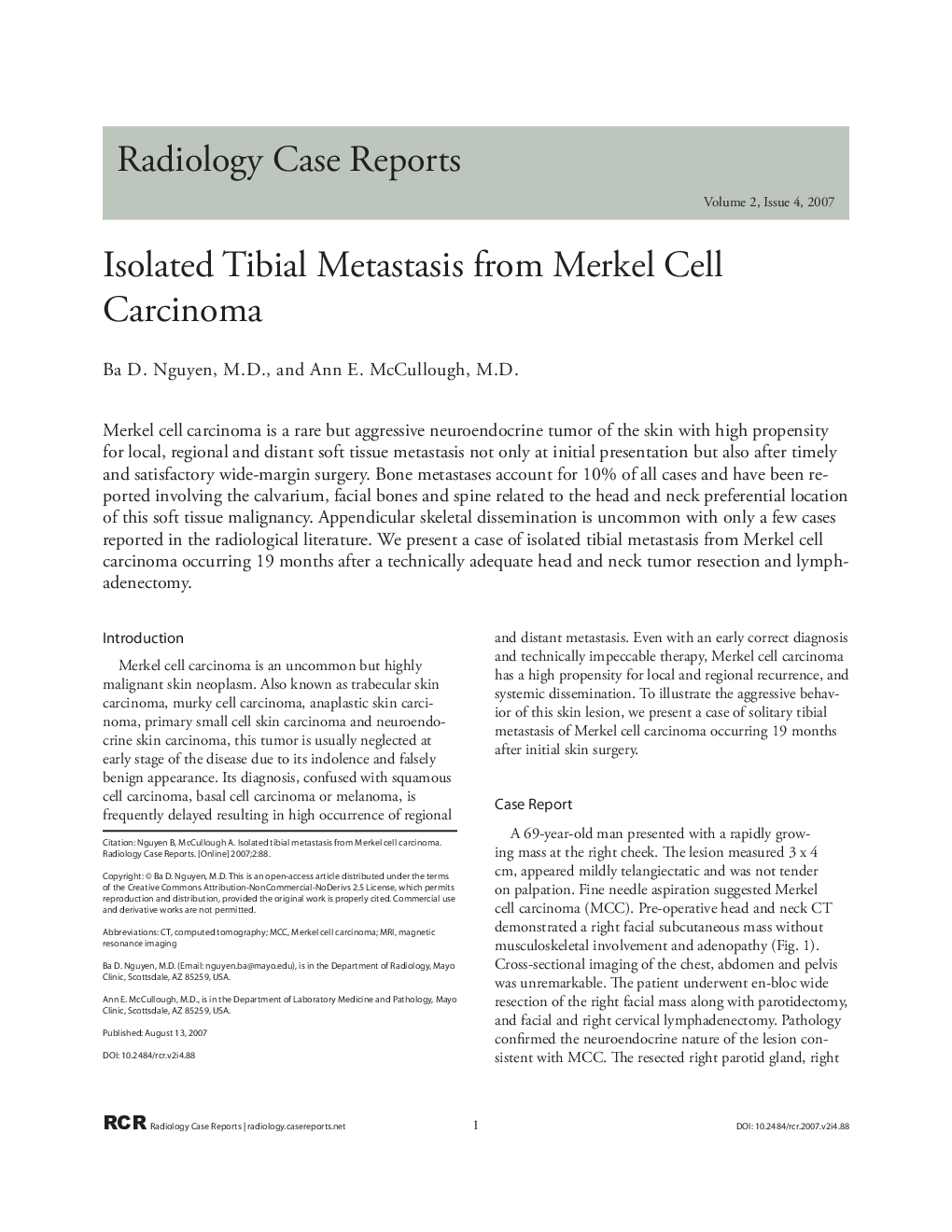 Isolated Tibial Metastasis from Merkel Cell Carcinoma