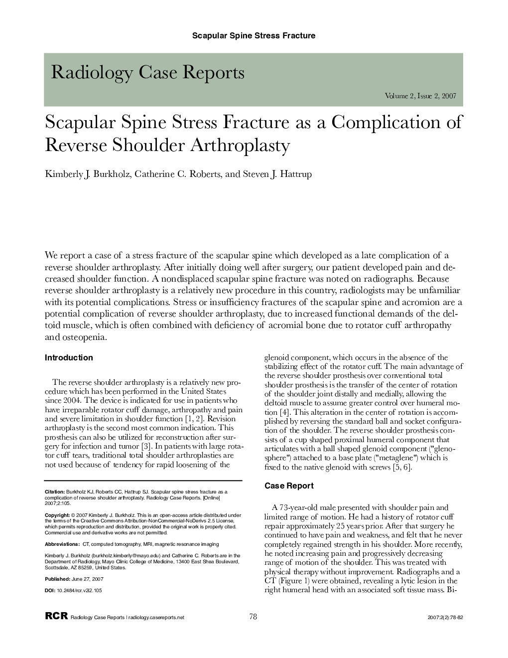 Scapular Spine Stress Fracture as a Complication of Reverse Shoulder Arthroplasty 