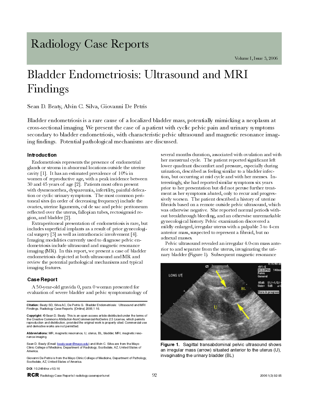 Bladder Endometriosis: Ultrasound and MRI Findings 