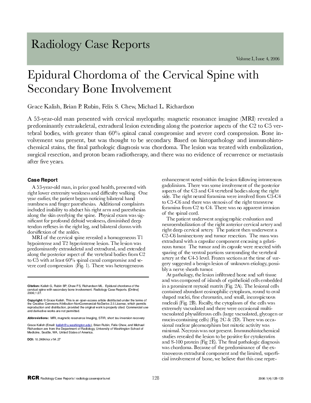 Epidural Chordoma of the Cervical Spine with Secondary Bone Involvement 