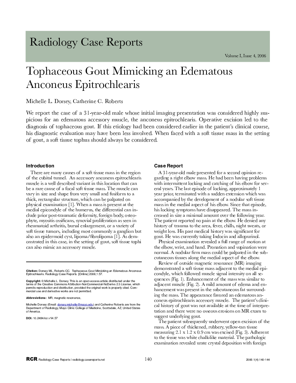 Tophaceous Gout Mimicking an Edematous Anconeus Epitrochlearis 