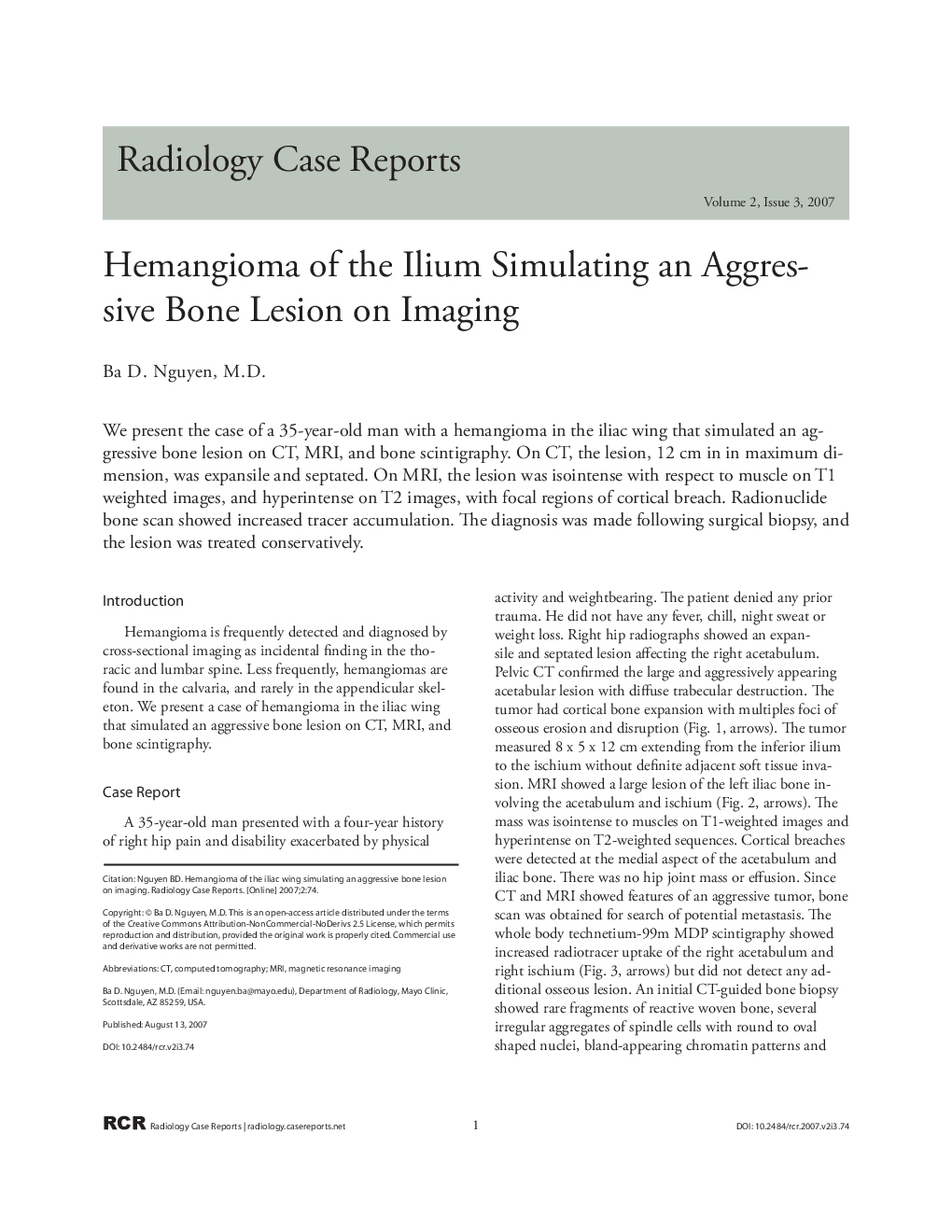 Hemangioma of the Ilium Simulating an Aggressive Bone Lesion on Imaging