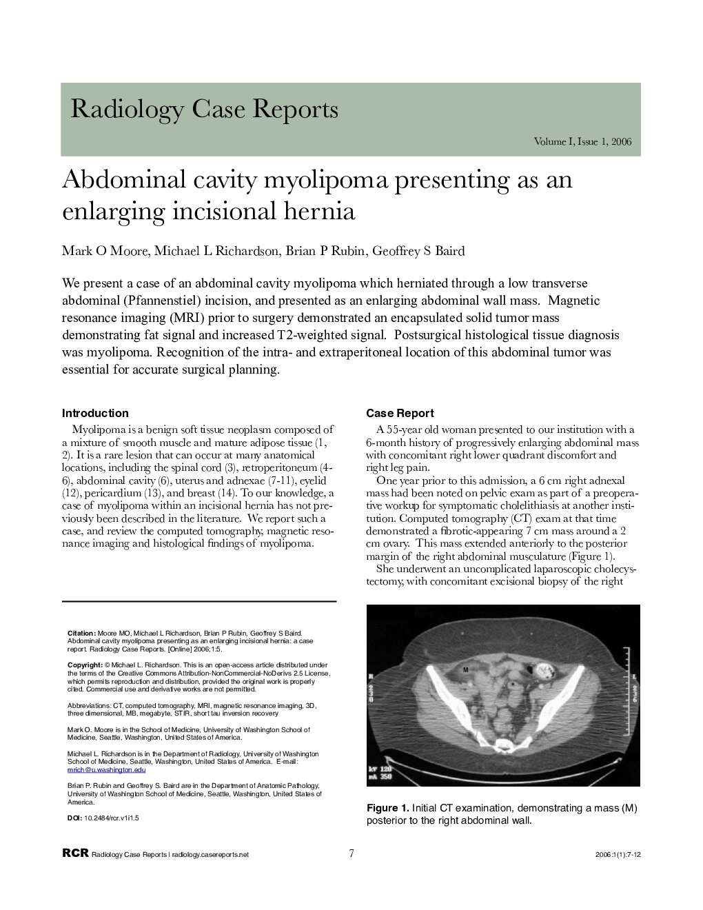 Abdominal cavity myolipoma presenting as an enlarging incisional hernia 