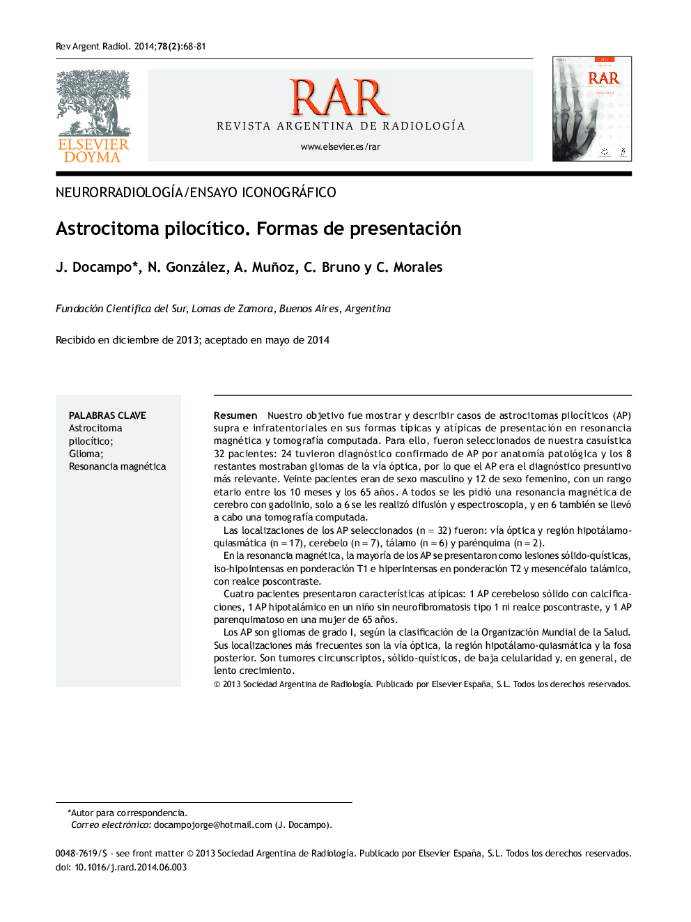 Astrocitoma pilocítico. Formas de presentación